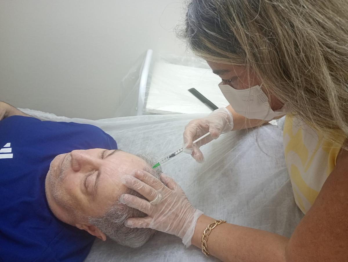 Aplicação de mesoterapia capilar